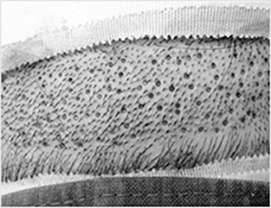 FUE微創植髮技術- 無需縫合，故無需拆線。（麻醉方法與切開法相同。）