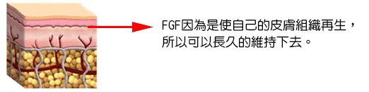FGF（細胞増殖因子）注入