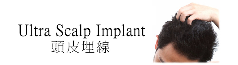 Ultra Scalp Implant頭皮埋線